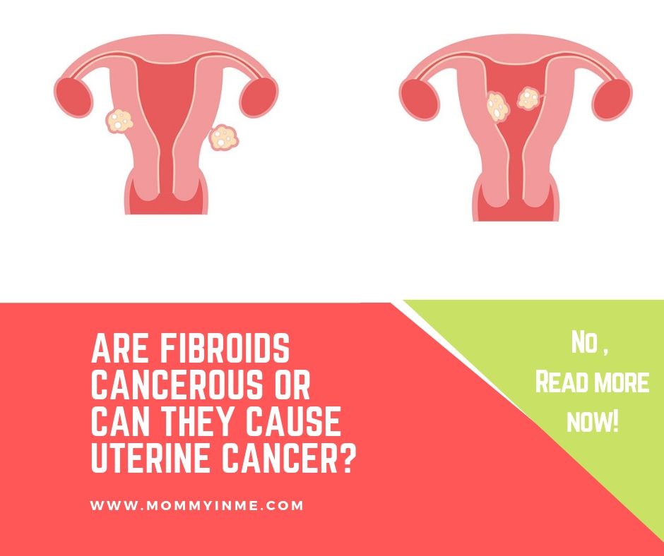 Fibroids become common in women during child bearing years. But there is a lot confusion around Fibroids, whether they are cancerous or can cause obesity and weight gain? Get answers to all your queries related to Uterine Fibroids by Cloudnine Hospital expert Dr Sripada Vinekar #cloudnine #fibroids #uterinefibroids #gynecologist #health #behealthy #noncancerous #womenhealth